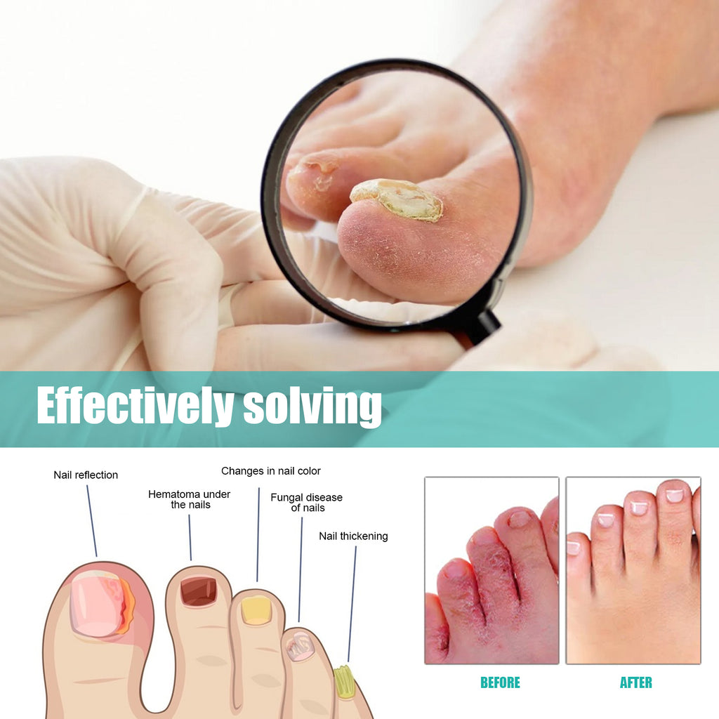 Nail Care Spray Soft Nails Thickening Nails Gray Nails Cleaning Odor Brightening Nails Spray