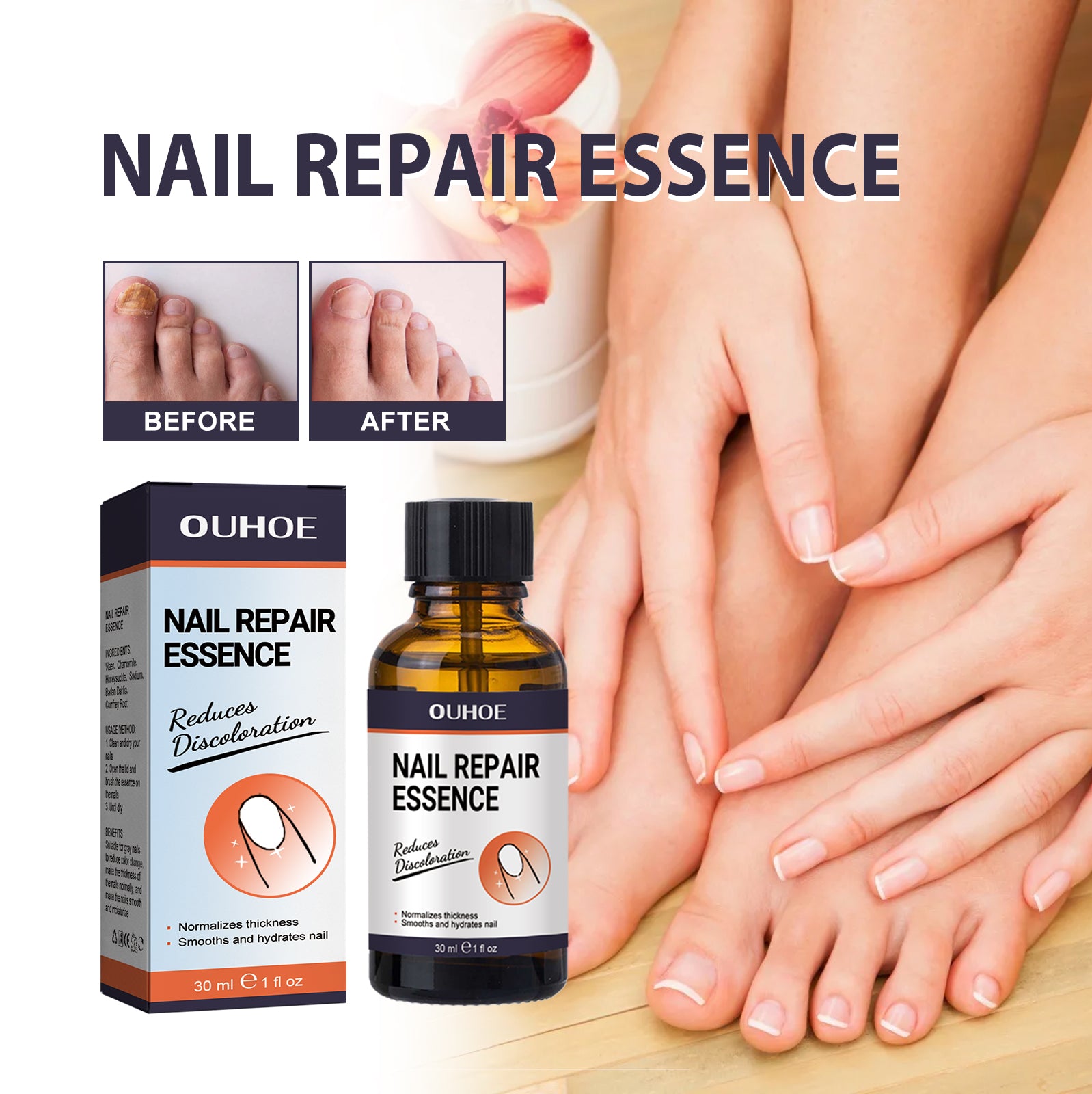 Nail Repair Essence, Soft Nail Thickening Nails Smooth Ingrown Toenails Grey Nails Repair Essence