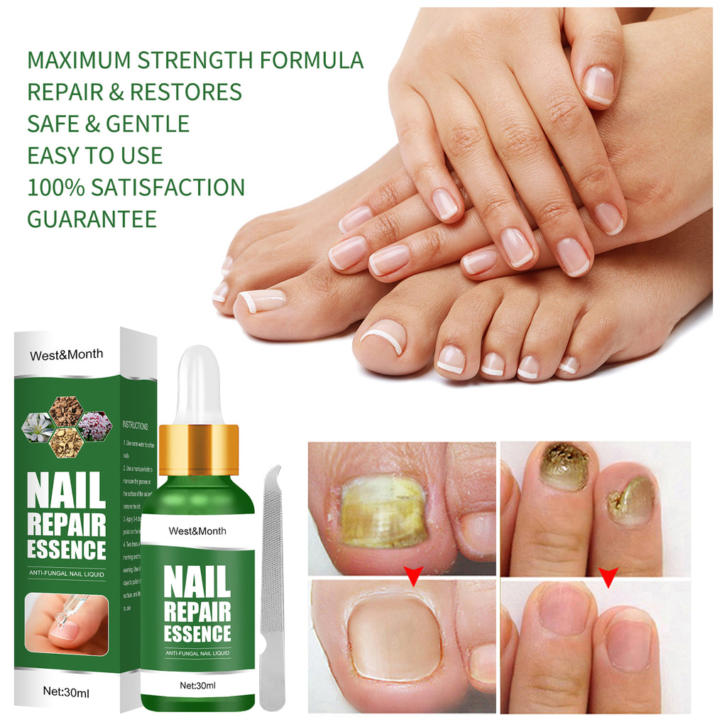 Nail Repair Essence, Hand And Foot Thickening Brightening Nails Repair Rotten Nails Bad Nails Remove Ash Nail Infection Clean
