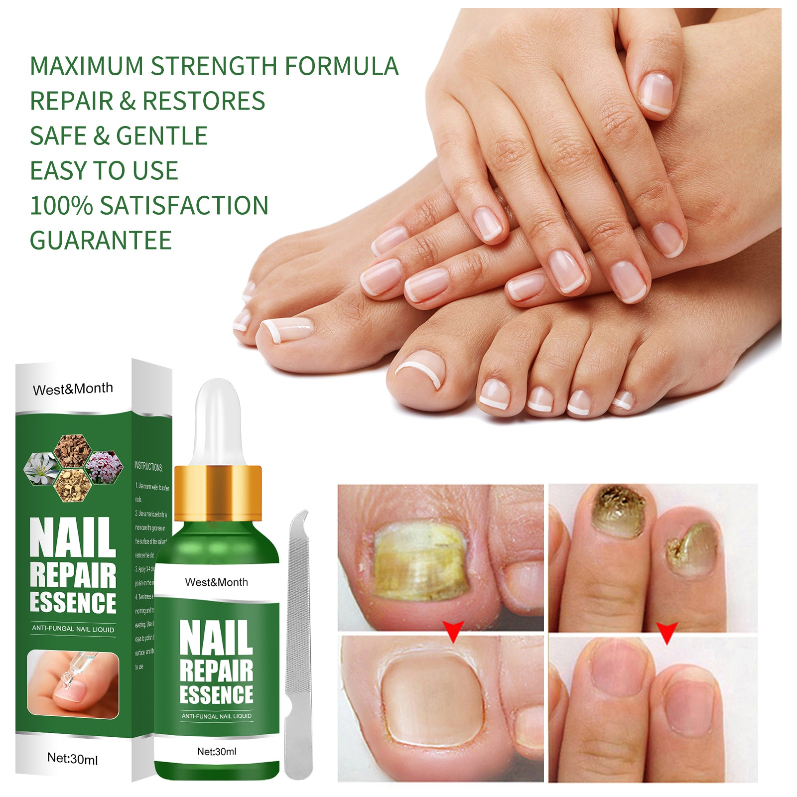 Nail Repair Essence, Hand And Foot Thickening Brightening Nails Repair Rotten Nails Bad Nails Remove Ash Nail Infection Clean