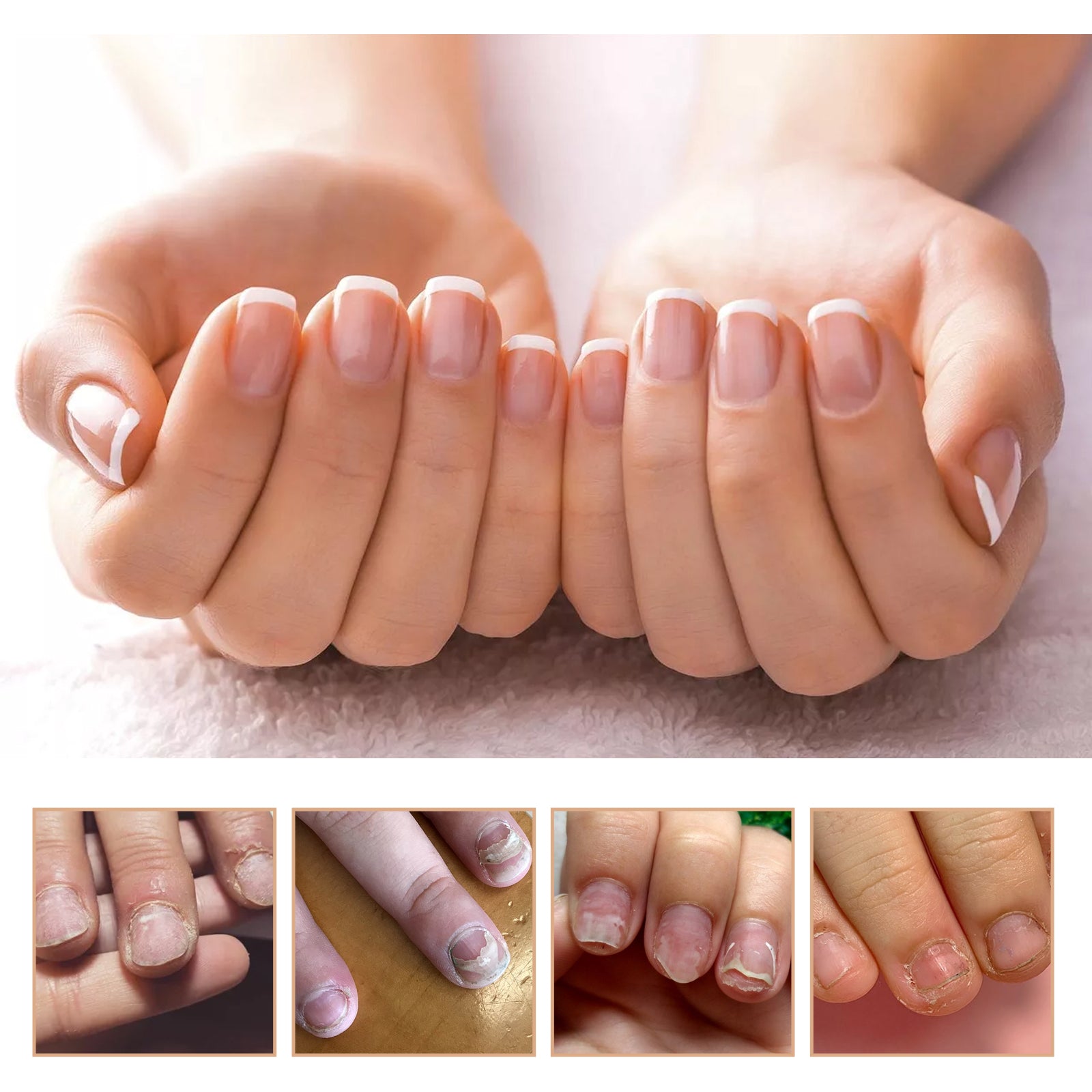 Nail Care Cream Hand, Foot And Nails Gentle Clean Soft Nails Shine Nail Care Cream